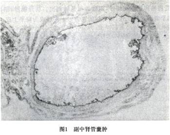 第三代三代供精是最好的吗？