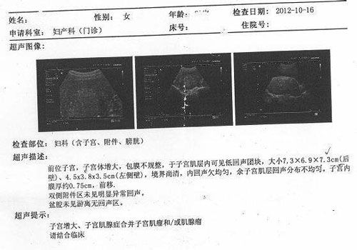 借精哪些女明星是试管代怀多少钱？收费标准请看介绍