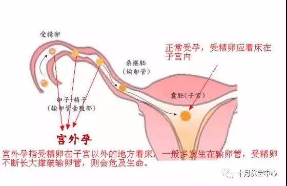 代怀性别男孩违法吗90%不是自己的（听谁瞎说的）