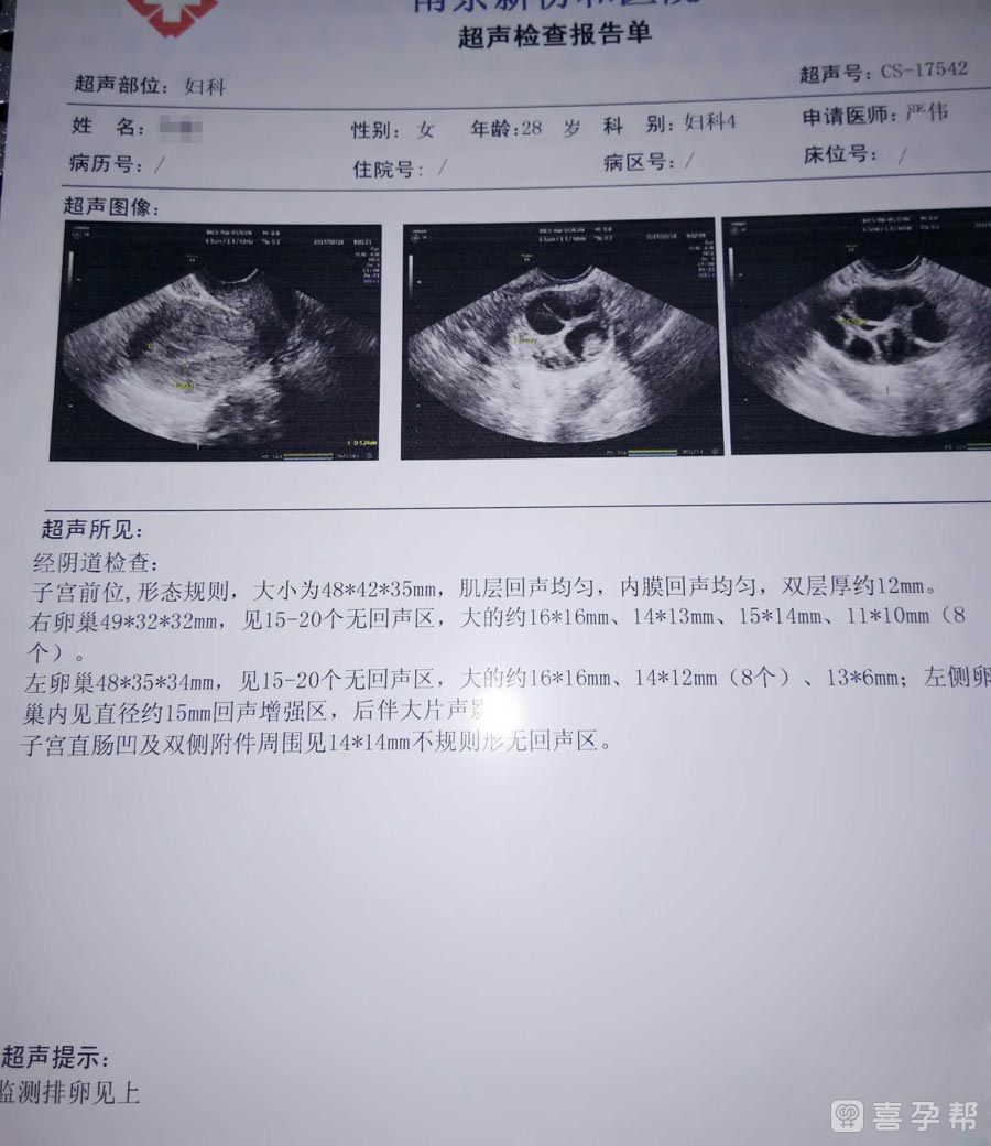 做输卵管通水手术的过程是怎么样的（有详细步骤图片吗？）