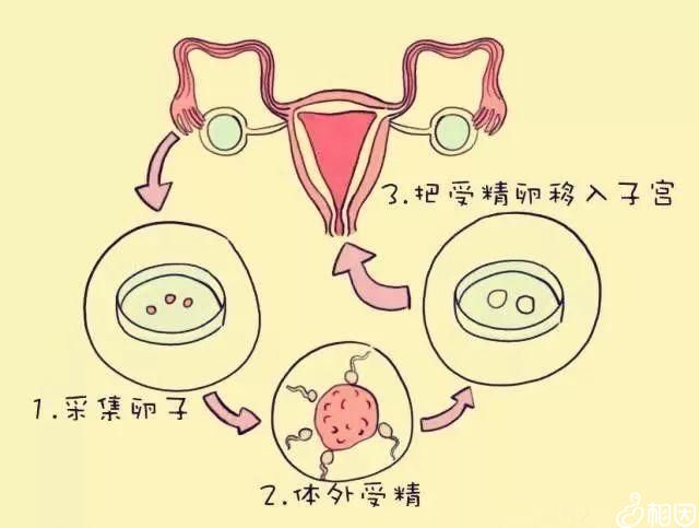 供卵怀孕公司两个胚胎多少钱